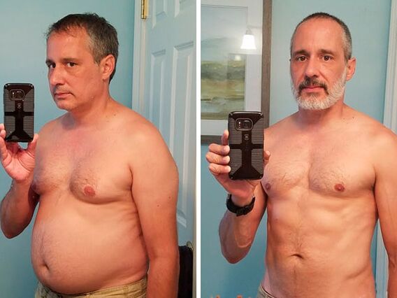 Antes e despois do tratamento con pingas Alcozar